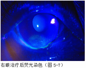ZY016_21_4.gif